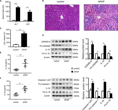 Peroxiredoxin 3 Inhibits Acetaminophen-Induced Liver Pyroptosis Through the Regulation of Mitochondrial ROS